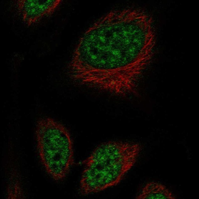 Immunofluorescent staining of human cell line SiHa shows localization to nuclear speckles. Antibody staining is shown in green.