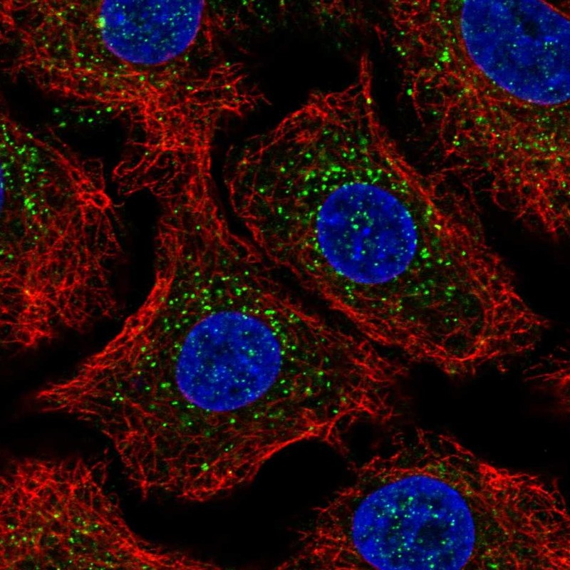 Immunofluorescent staining of human cell line A549 shows localization to vesicles. Antibody staining is shown in green.