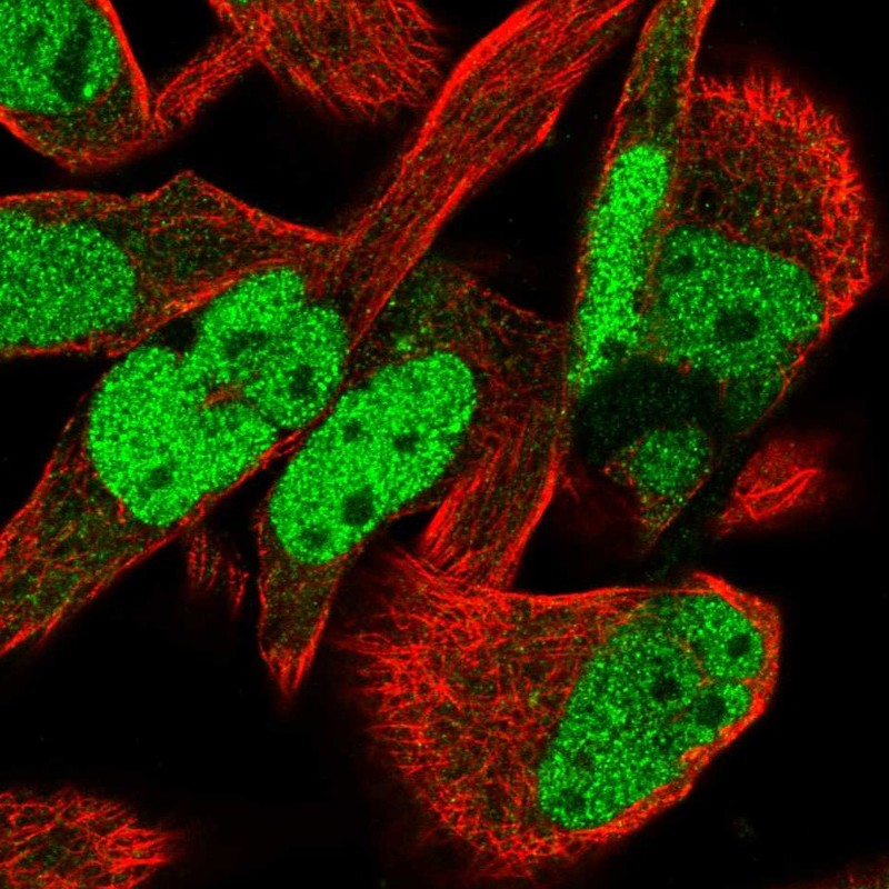 Immunofluorescent staining of human cell line RH-30 shows localization to nucleoplasm. Antibody staining is shown in green.