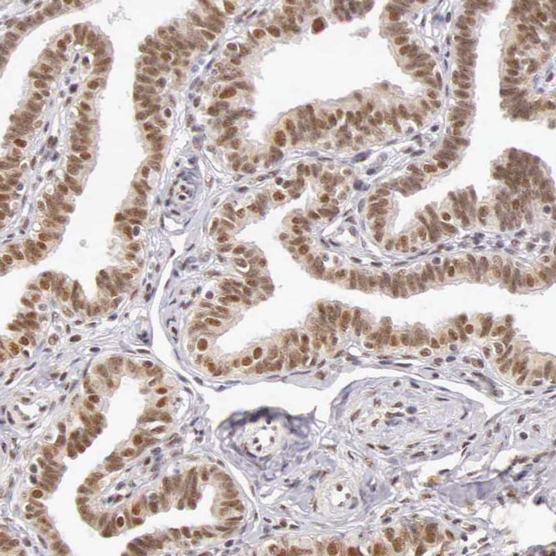 Immunohistochemical staining of human fallopian tube shows nuclear positivity in glandular cells.
