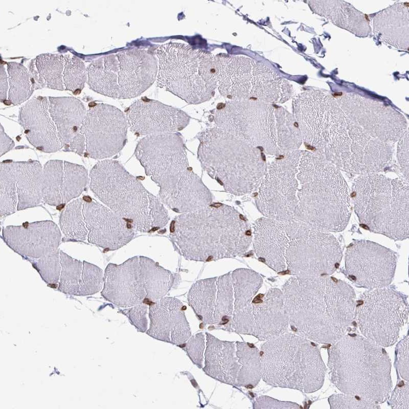 Immunohistochemical staining of human skeletal muscle shows moderate nuclear membrane positivity in myocytes.