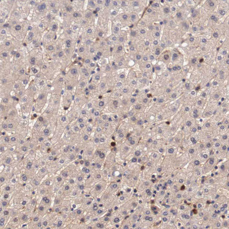 Immunohistochemical staining of human liver shows moderate cytoplasmic positivity in a subset of hepatocytes.