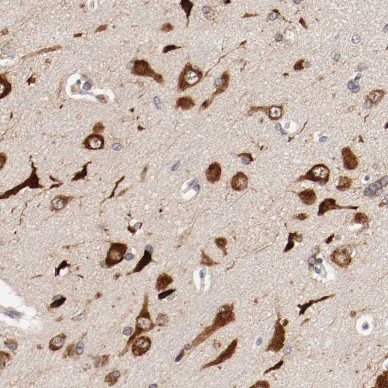 Immunohistochemical staining of human cerebral cortex shows strong cytoplasmic positivity in neuronal and glial cells.