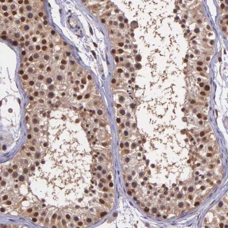 Immunohistochemical staining of human testis shows strong nuclear positivity in cells in seminiferous ducts.