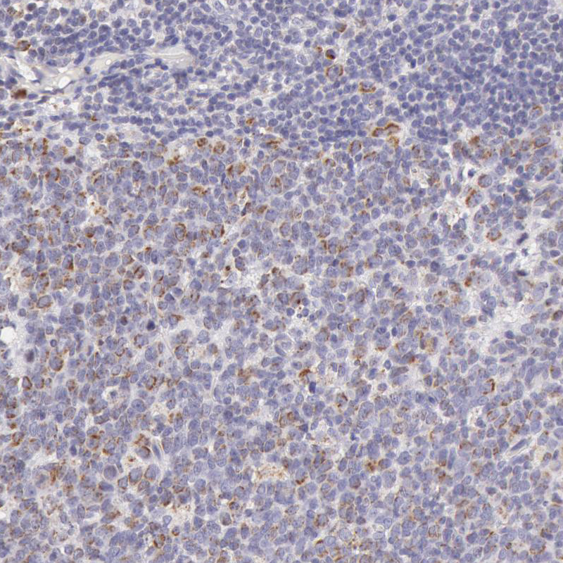 Immunohistochemical staining of human tonsil shows weak granular cytoplasmic positivity in lymphoid cells, mainly in reaction centrum.