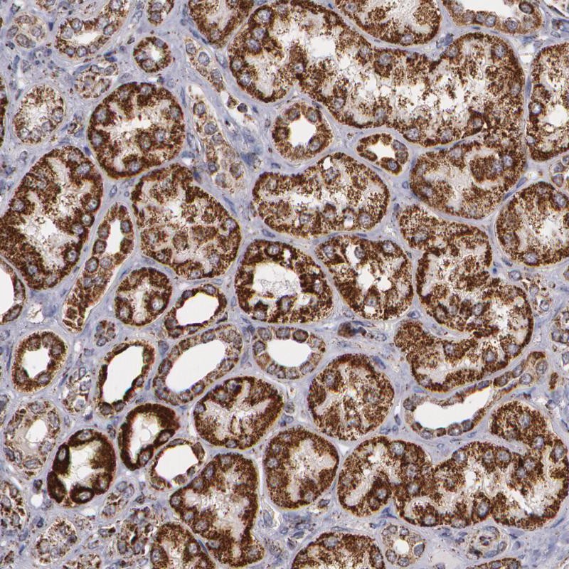 Immunohistochemical staining of human kidney shows strong cytoplasmic positivity in cells of renal tubules.