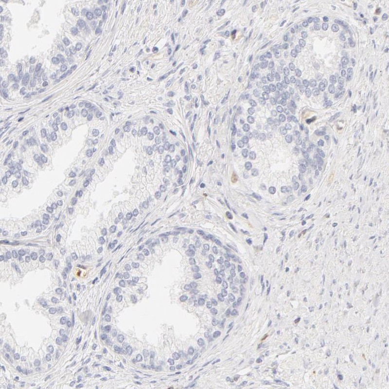Immunohistochemical staining of human prostate shows low expression as expected.