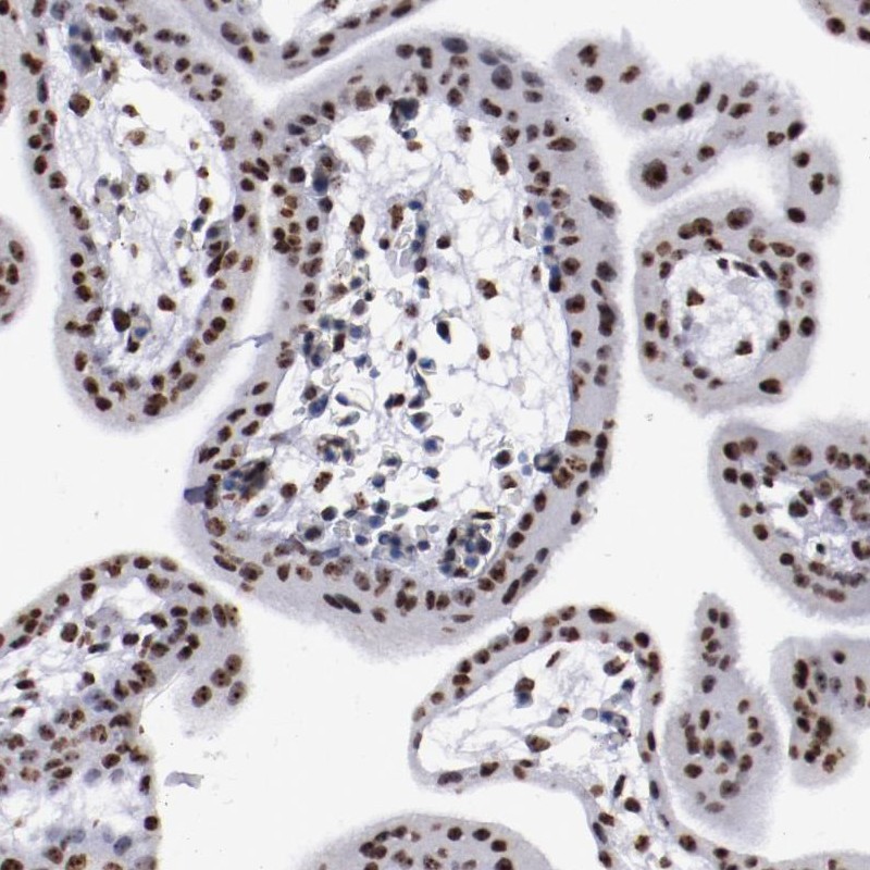 Immunohistochemical staining of human placenta shows strong nuclear positivity in trophoblastic cells.