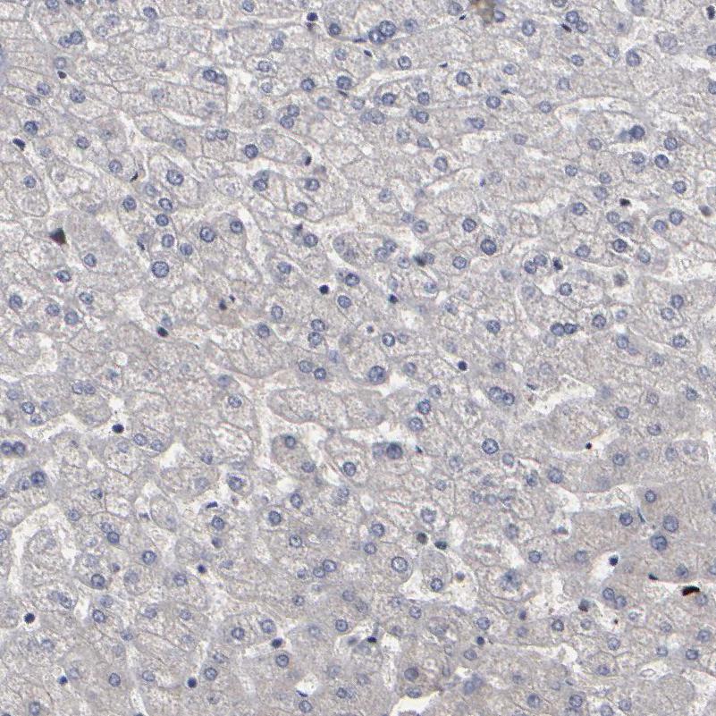 Staining of human liver shows no positivity in hepatocytes as expected.