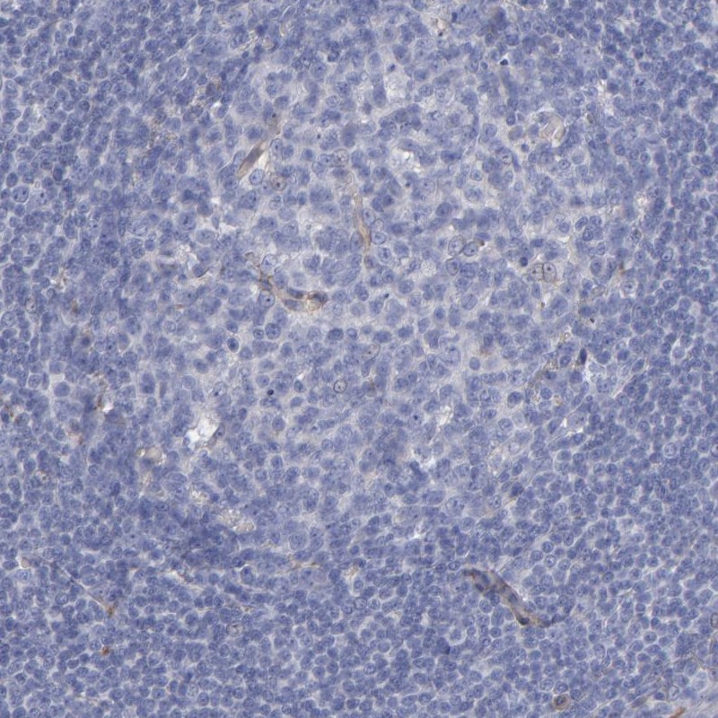Immunohistochemical staining of human tonsil shows low expression as expected.