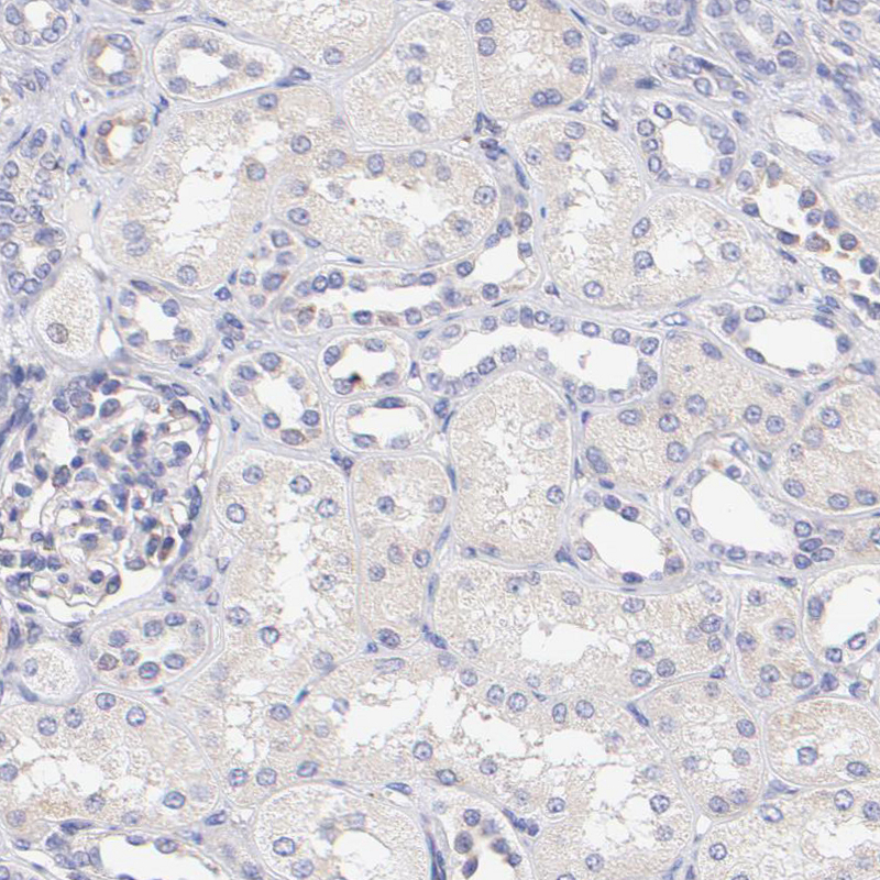 Immunohistochemical staining of human kidney shows no cytoplasmic positivit  as expected.