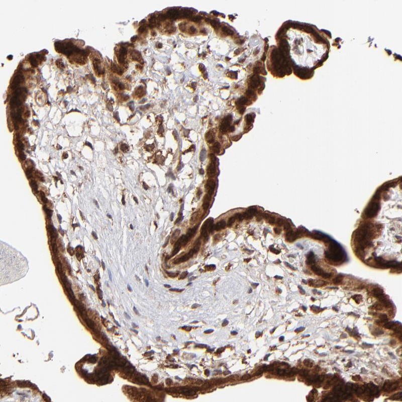 Immunohistochemical staining of human placenta shows strong cytoplasmic and nuclear positivity in trophoblastic cells.