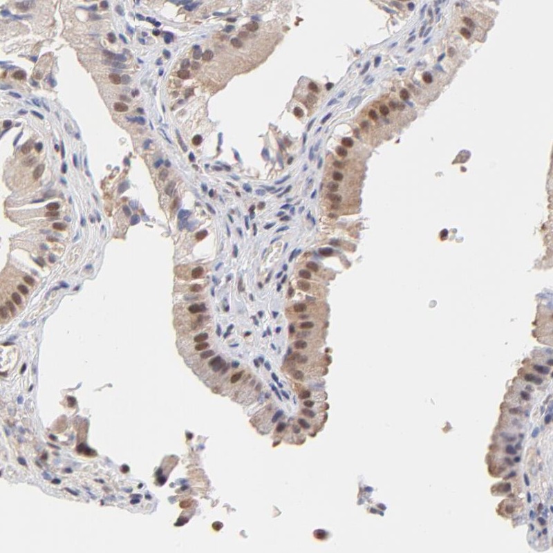 Immunohistochemical staining of human gall bladder shows nuclear positivity in glandular cells.