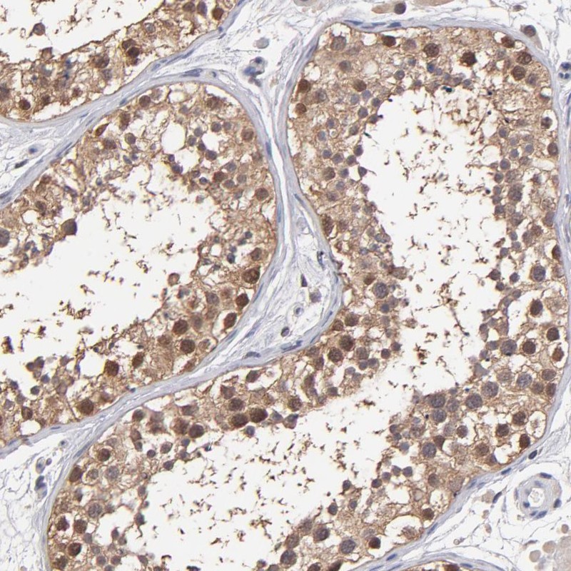 Immunohistochemical staining of human testis shows moderate cytoplasmic and nuclear positivity in cells of seminiferous ducts.