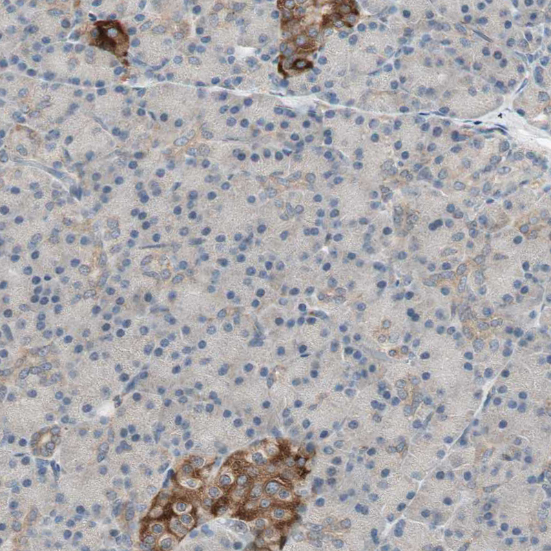 Immunohistochemical staining of human pancreas shows positivity in islets of Langerhans.