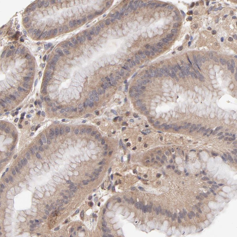 Immunohistochemical staining of human stomach shows cytoplasmic positivity in glandular cells.
