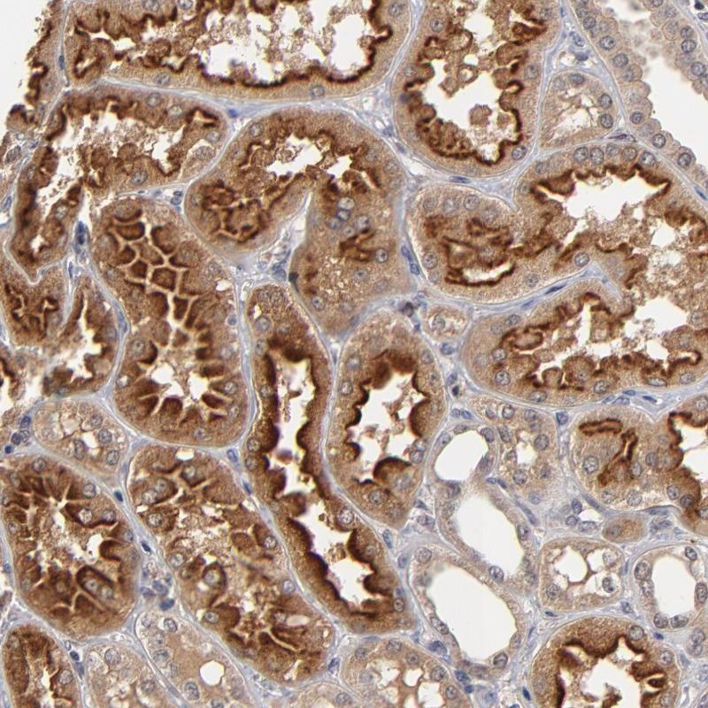 Immunohistochemical staining of human kidney shows strong cytoplasmic positivity in cells in tubules.