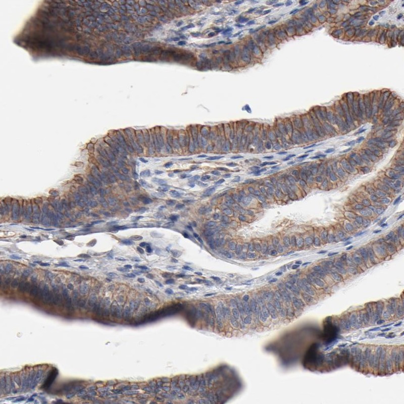 Immunohistochemical staining of human fallopian tube shows membrane positivity in glandular cells.