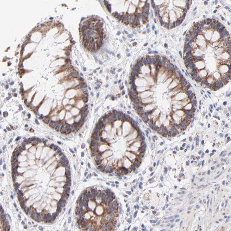 Immunohistochemical staining of human rectum shows cytoplasmic positivity in glandular cells.