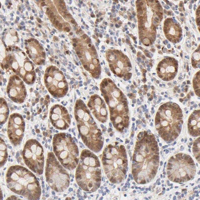 Immunohistochemical staining of human duodenum shows moderate cytoplasmic and nuclear positivity in glandular cells.