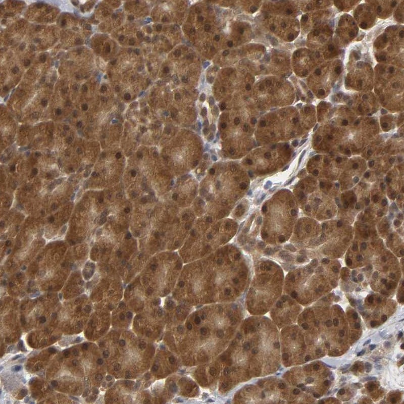 Immunohistochemical staining of human pancreas shows cytoplasmic and nuclear positivity in exocrine glandular cells.