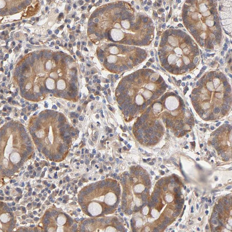Immunohistochemical staining of human duodenum shows moderate cytoplasmic positivity in glandular cells.