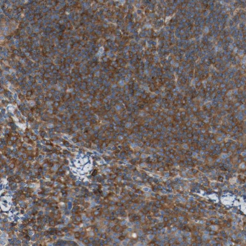 Immunohistochemical staining of human lymph node shows strong cytoplasmic positivity in lymphoid cells outside reaction centra.