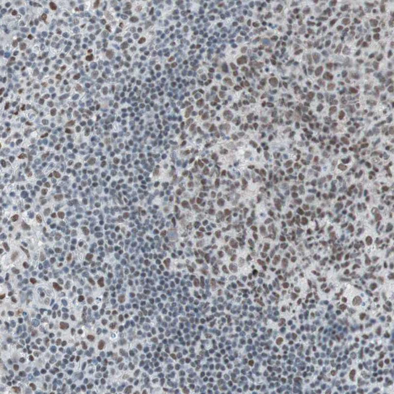 Immunohistochemical staining of human lymph node shows moderate nuclear positivity in lymphoid cells.