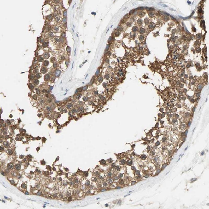 Immunohistochemical staining of human testis shows moderate cytoplasmic positivity in cells in seminiferus ducts.
