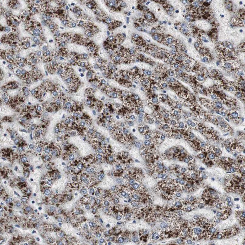 Immunohistochemical staining of human liver shows strong granular cytoplasmic positivity in hepatocytes.