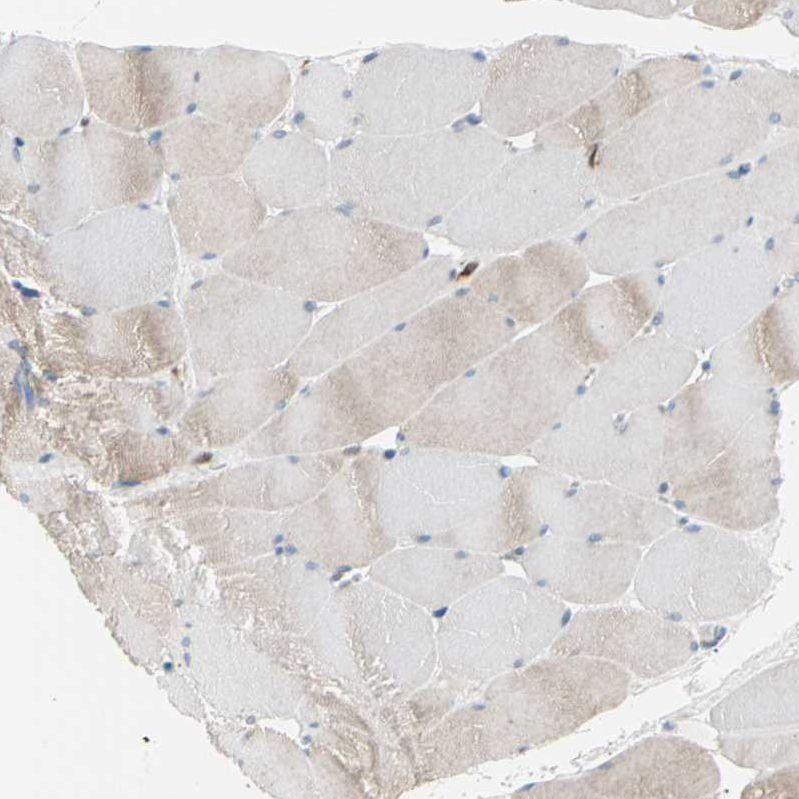 Immunohistochemical staining of human skeletal muscle shows weak to no positivity in myocytes as expected.