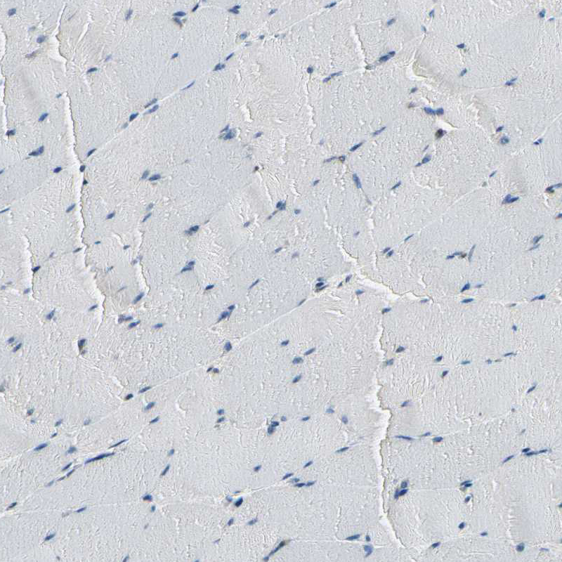 Immunohistochemical staining of human skeletal muscle shows no positivity in myocytes as expected.