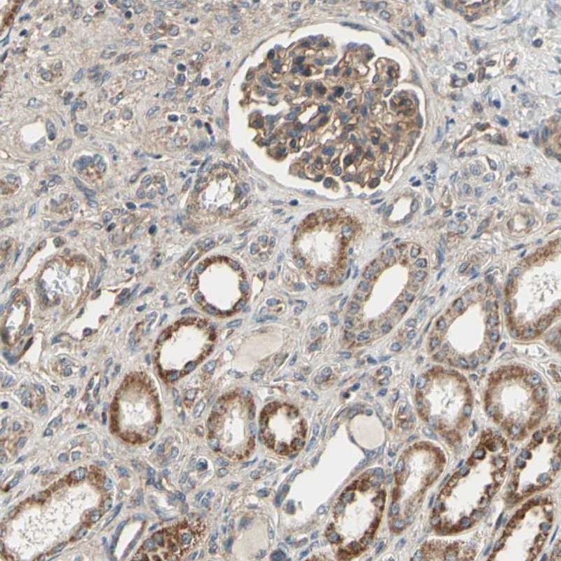 Immunohistochemical staining of human kidney shows moderate cytoplasmic positivity in cells in tubules and cells in glomeruli.
