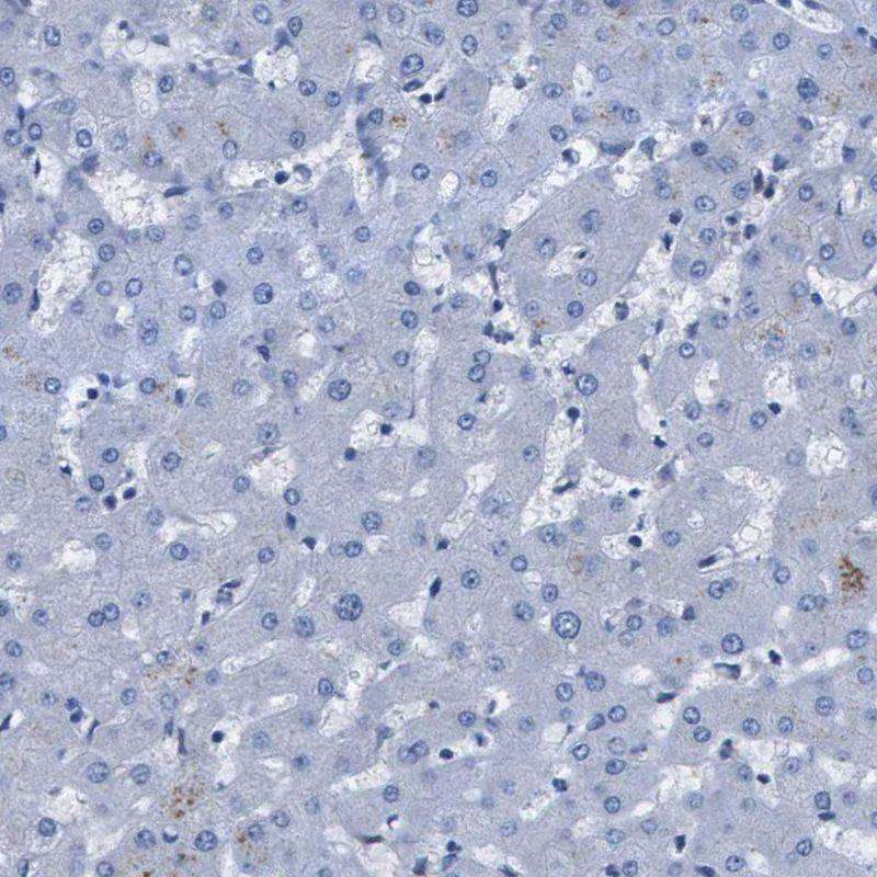 Immunohistochemical staining of human liver shows no positivity in hepatocytes as expected.