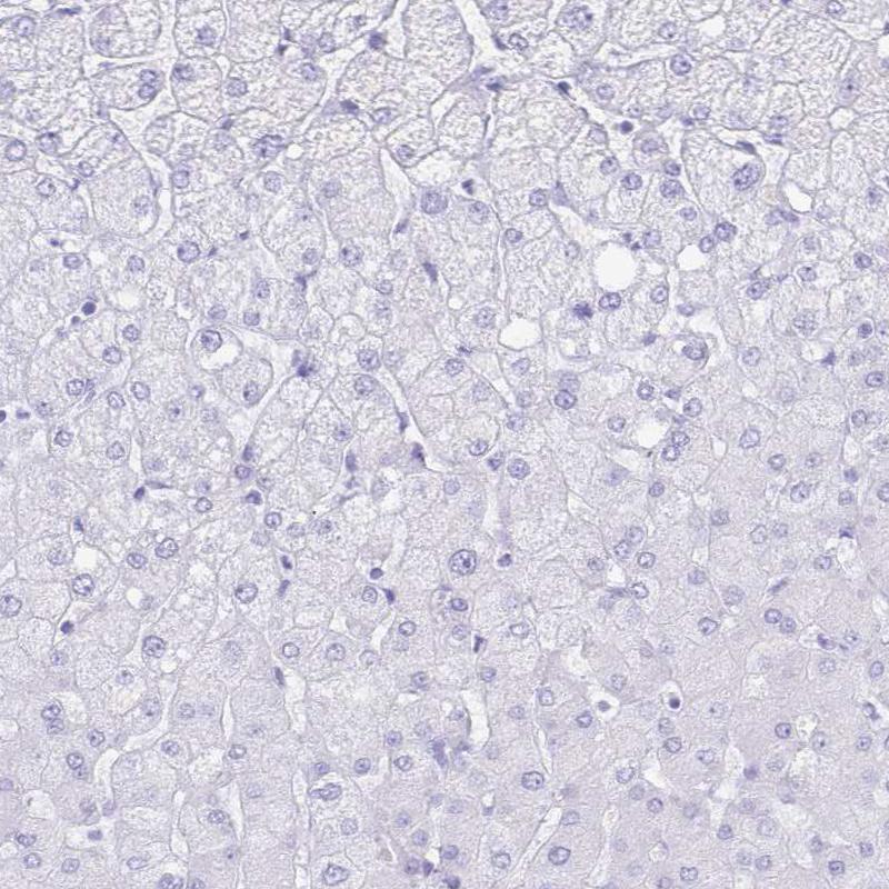 Immunohistochemical staining of human liver shows no positivity in hepatocytes, as expected.