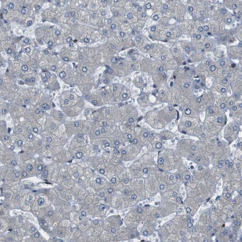 Immunohistochemical staining of human liver shows very weak nuclear positivity in hepatocytes.