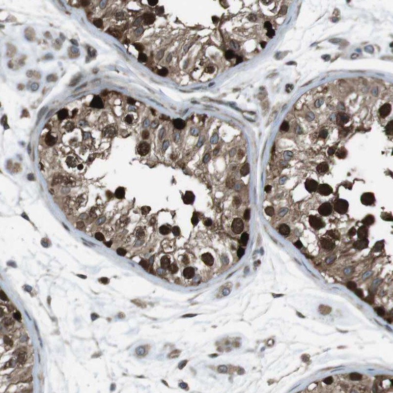 Immunohistochemical staining of human testis shows strong nuclear and cytoplasmic positivity in cells in seminiferus ducts.