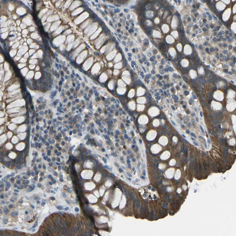 Immunohistochemical staining of human colon shows moderate cytoplasmic positivity in glandular cells.