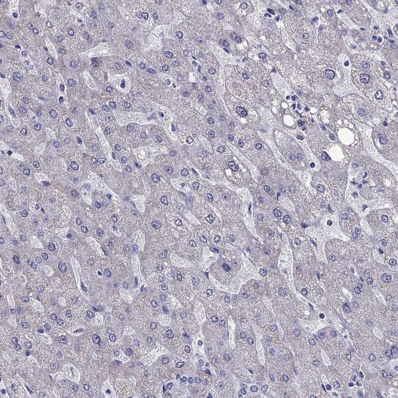 Immunohistochemical staining of human liver shows low expression as expected.