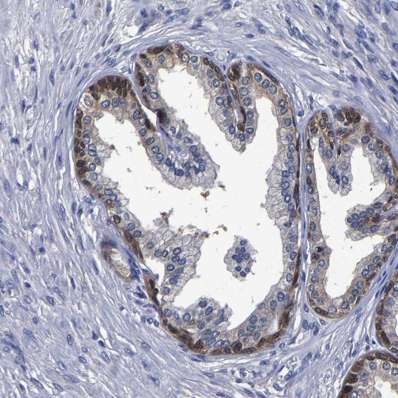 Immunohistochemical staining of human prostate shows strong positivity in basal cells.