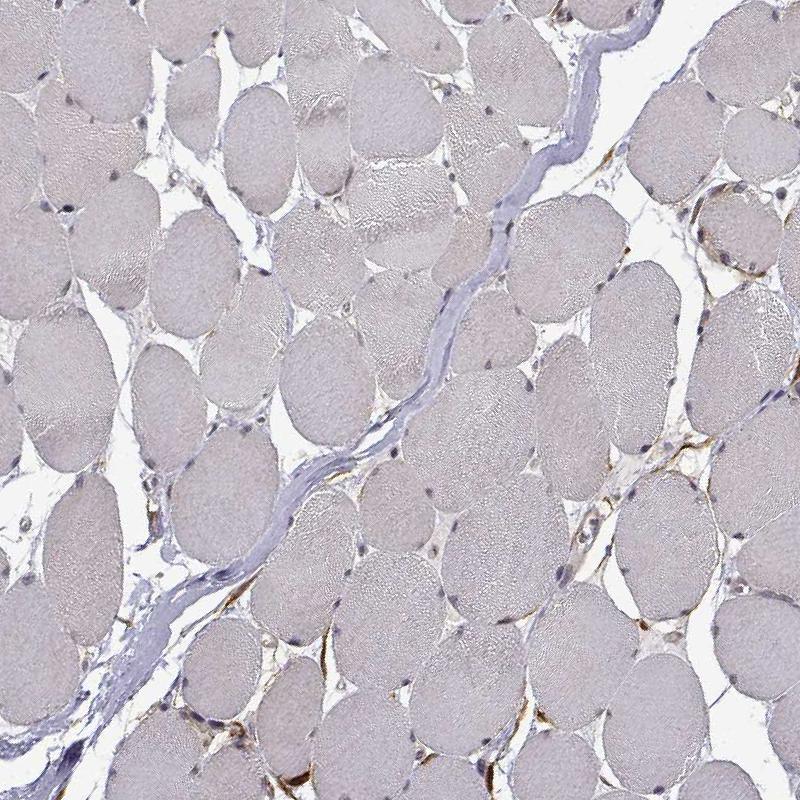 Immunohistochemical staining of human skeletal muscle shows no positivity as expected.