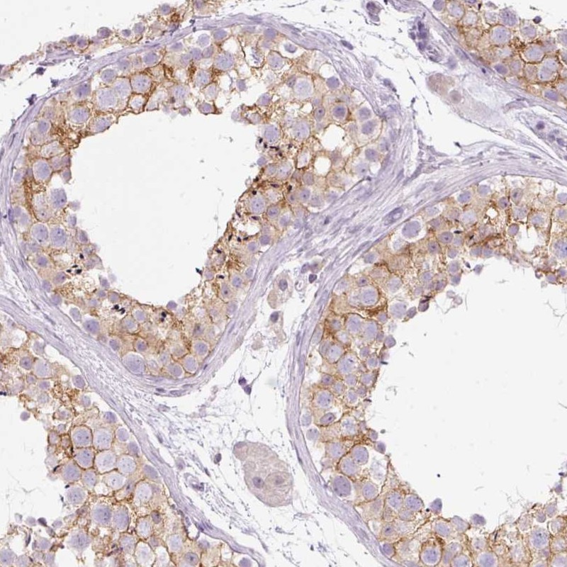 Immunohistochemical staining of human testis shows membranous and cytoplasmic positivity in cells in seminferous ducts.