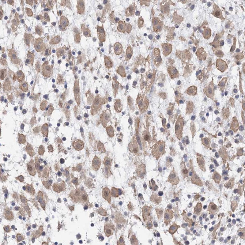 Immunohistochemical staining of human placenta shows cytoplasmic positivity in decidual cells.