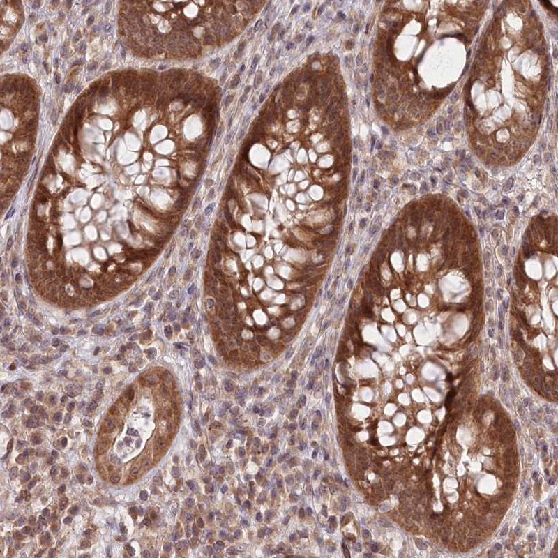 Immunohistochemical staining of human rectum shows strong cytoplasmic and nuclear positivity in glandular cells.