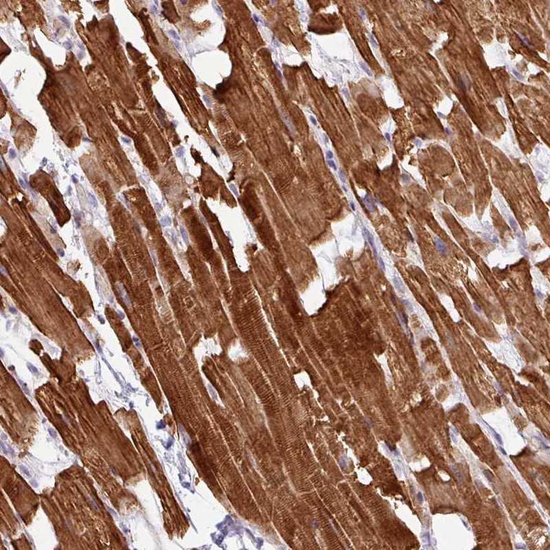 Immunohistochemical staining of human heart muscle shows strong cytoplasmic positivity in myocytes.