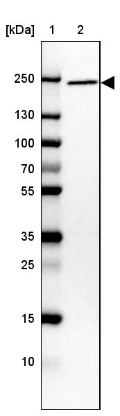 Lane 1: Marker [kDa] 250, 130, 100, 70, 55, 35, 25, 15, 10<br/>Lane 2: Human cell line CACO-2