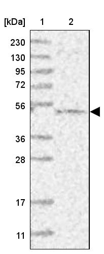 Lane 1: Marker [kDa] 230, 130, 95, 72, 56, 36, 28, 17, 11<br/>Lane 2: Human cell line RT-4