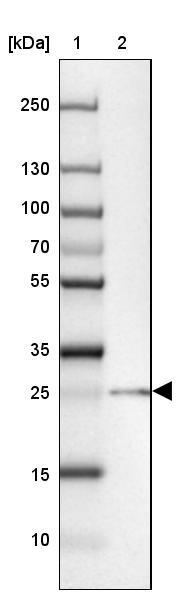 Lane 1: Marker [kDa] 250, 130, 100, 70, 55, 35, 25, 15, 10<br/>Lane 2: Human cell line MOLT-4