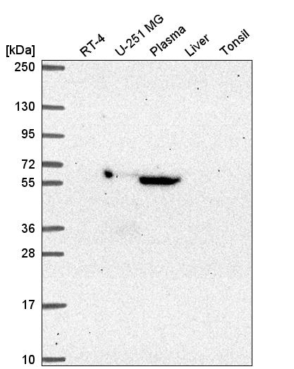 Western blot analysis in human cell line RT-4, human cell line U-251 MG, human plasma, human liver tissue and human tonsil tissue.