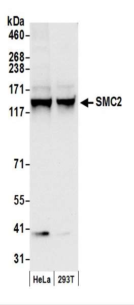 抗SMC2抗体の使用例画像